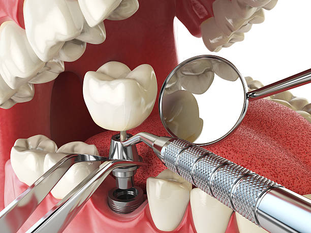Best Emergency Broken Tooth Repair in Knightsen, CA
